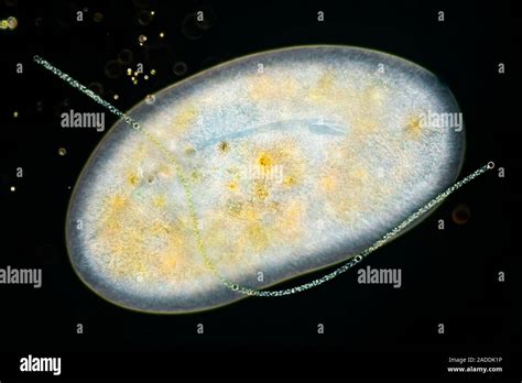 Armoured Ciliate: A Single-Celled Wonder Hiding in Plain Sight!