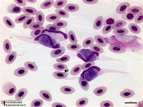  Leucocytozoon! Yksi loinen luomassa mikroskooppisen myrskyn lintujen veressä