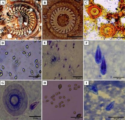  Mikrosporidia: Mikroskooppisen maailmannäkymä! Mikrosporidia ovat mikroskooppisia loisieläimiä, jotka tartuttavat useita eläinryhmiä ja niiden monimutkainen elinkierto on kiehtova tutkittava.